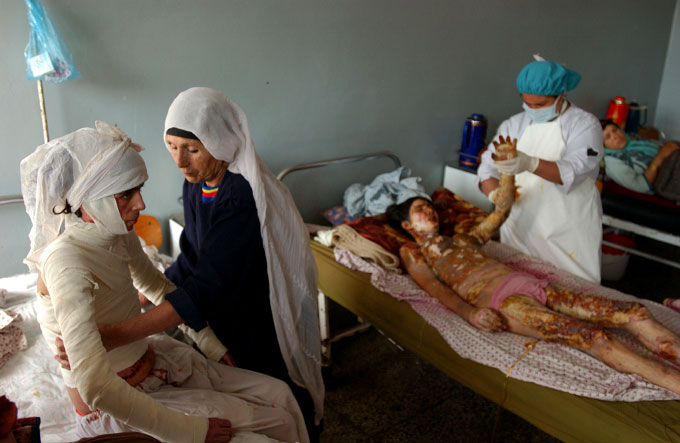 Parigul, 22 year-old, (left) being bandaged by her mother in the Herat Hospital more than a month after she was admitted for severe burns over 50% of her body. Parigul is one of the many women in Herat, Afghanistan who have turned to self immolation as a rebellion against unbearable marriage. Although self immolation continues to be a large problem in the city of Herat, sources say that the situation is getting better. According to doctors at the Herat hospital and the Independent Human Rights Comission there have been more than 100 cases of self immolation in Herat alone. This is an improvement from last year's 300 cases.