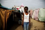 At Pone Rouge refugee camp, face injured 13 year Haitian quake IDP Sophia Lovelie stays next to her tent where she and 5 other family members live together. She lost two cousins due to the January 12th earthquake.
