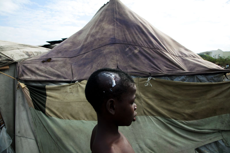 Head injured 12 year Haitian quake IDP Fedner Seraphin in front of his tent at Pone Rouge refugee camp.