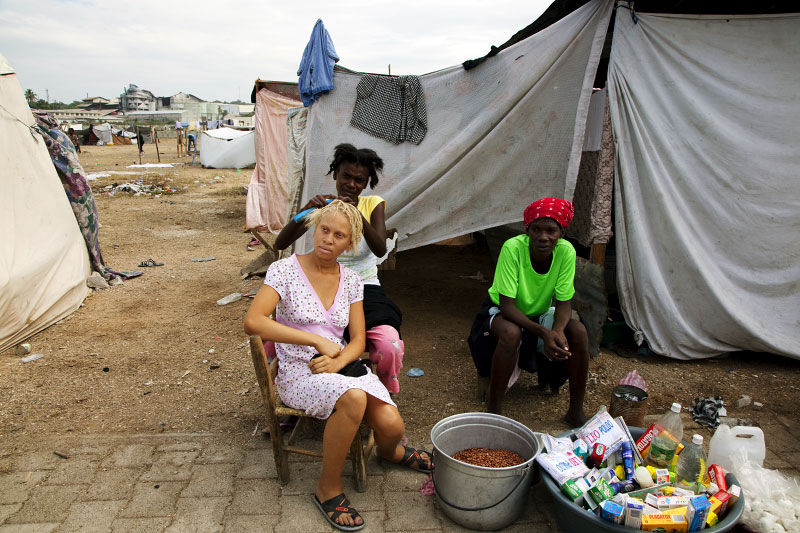 At Pont-Rouge refugee camp, 19 year old  albino Linda Colas is cared for her braid hair by her 27 year old friend Marie France Thomas, who stays next to her 48 year old relative Marie Louroes , in front of their tent. All of the three are the survivors of the January 12th earthquake.