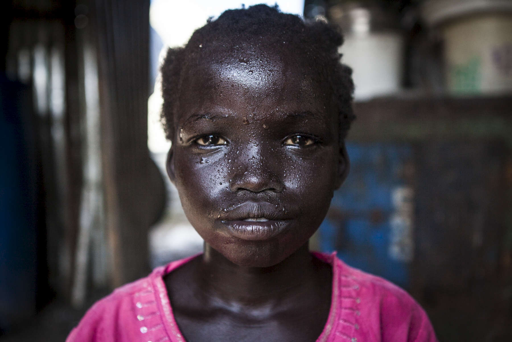 Mer, 10, covered in sweat from the afternoon heat before the rain, sits in her home in the Protection of Civilians (POC) site at the UNMISS base in Malakal, South Sudan on Friday, July 8, 2016.  