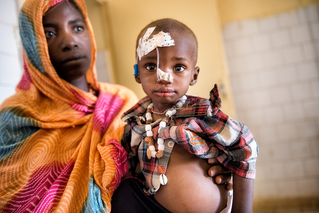 About Olud Mohammad, 22 months old child with severe malnutrition. Admitted to CRENI on 23.April.2015 