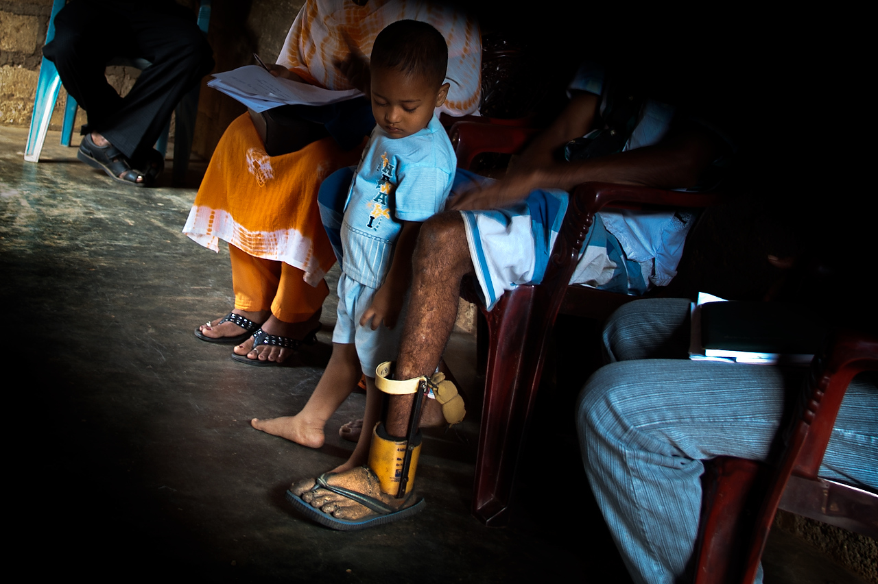 A boy looks his father's prosthetic foot. Mahmood is the land mine survivor and the Internally Displaced person from Sampur. He lost his foot while fetching firewood. It is estimated that more than 700,000 anti personel mines were planted by government forces and the LTTE in Sri Lanka.