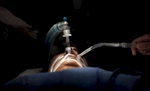 A patient lies in sedation while undergoing a hysterectomy.