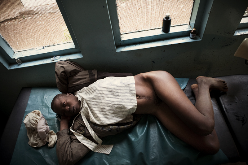 KISUMU – JULY 4: A 24 year old Kenyan woman relaxes on a bed in Kisumu District Hospital after a speculum exam shows that she is suffering from septic abortion in Kenya on July 4th, 2010. Septic abortion whether spontaneous or induced is the termination of a pregnancy in which the mother's life may be threatened because of infection and germs. The woman requires immediate care, antibiotics and possibly evacuation of the uterus.