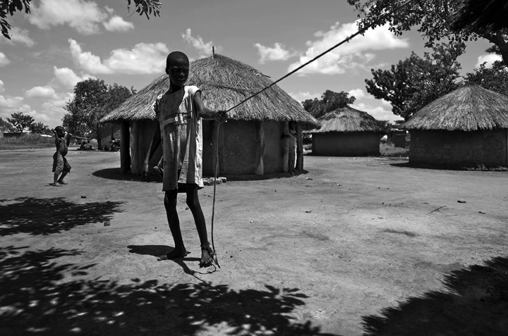 September 13, 2014 - Lapul - Ocwida village - Okot David, 18, standing  outside his hut. Okot represents a severe case of Nodding Syndrome; he has been ill with it since 2003. He's tied to his living quarters 24-hours a day, seven days a week. At an advanced stage the syndrome causes its victims to wander aimlessly, hence families will tie the person with a rope or chain to prevent them from getting lost, injured or in the case of a young woman raped. 