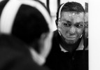 Shawn looks at himself as he tries on his custom-made mask, which reduces facial scarring. He finds the mask to be tight, hot and scary and decides he will deal with some disfigurement and skin discoloration rather than wear it 12 hours a day. 