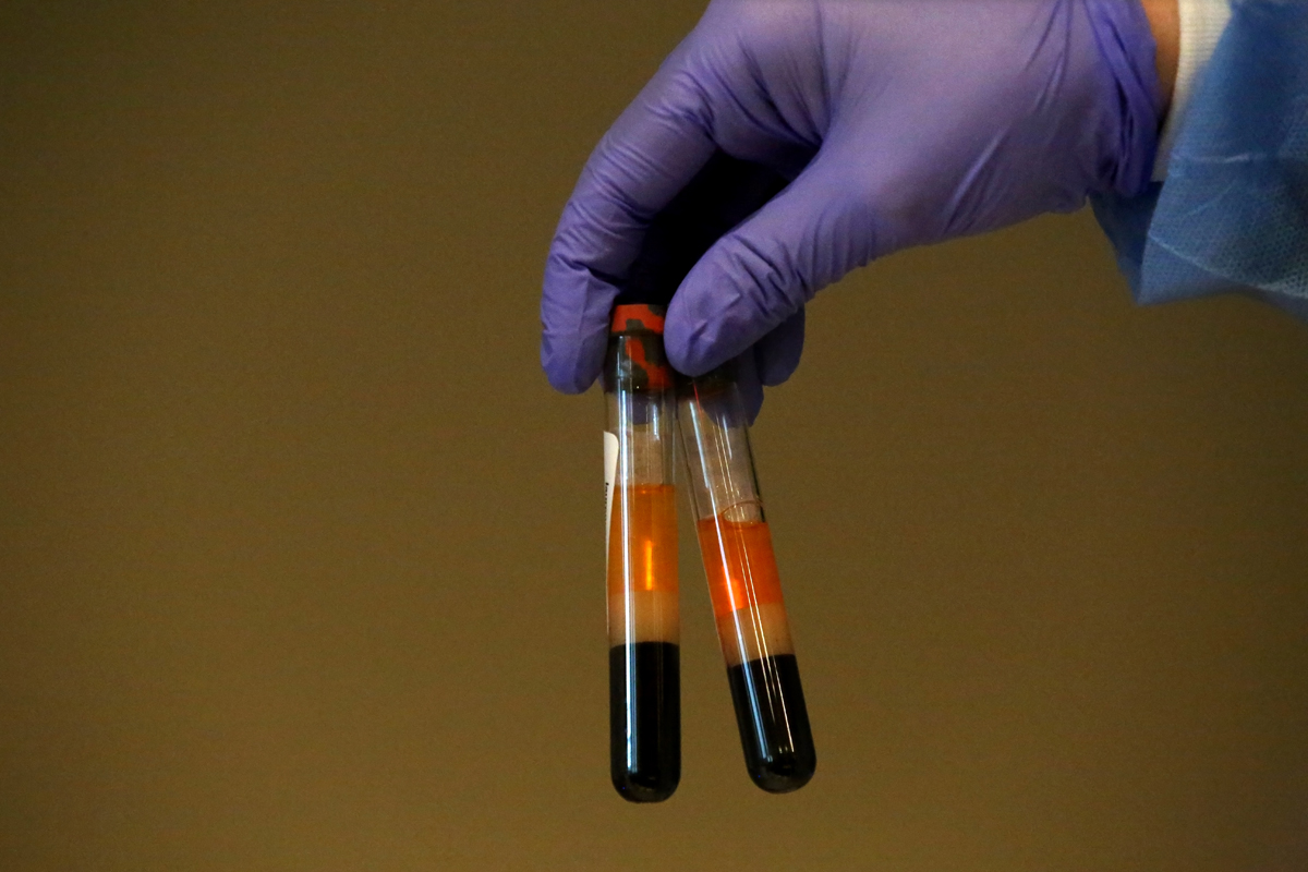 A phlebotomist shows to the camera specimens of people getting tested for coronavirus antibodies at the Refuah Health Center on April 24, 2020 in Spring Valley, NY. (Photo by Yana Paskova/Getty Images)