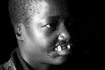 The shocking mutilation of womans faces is a scare tactic that the LRA use to install fear in the local camp residents. 