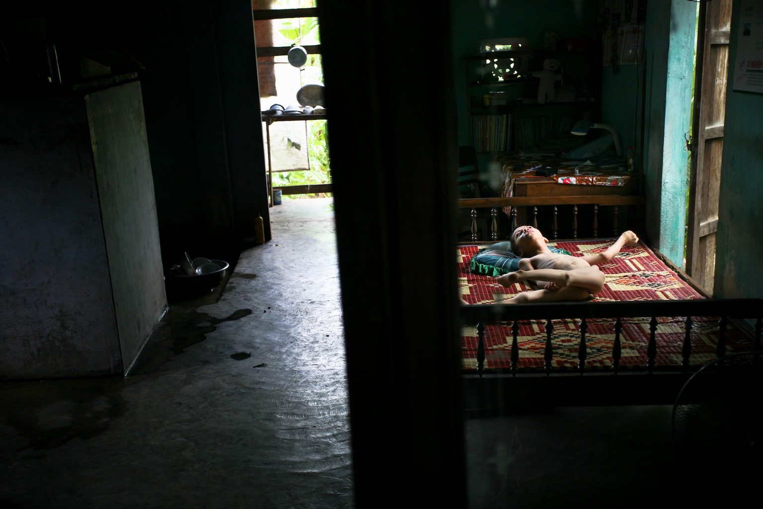 Nguyen Quang, 11, on his bed at home in the Kim Dong district of Hai Phong, Vietnam. Village presidents believe most of the children to be third generation Agent Orange victims due to the commonality in mental disorders and physical deformities. 