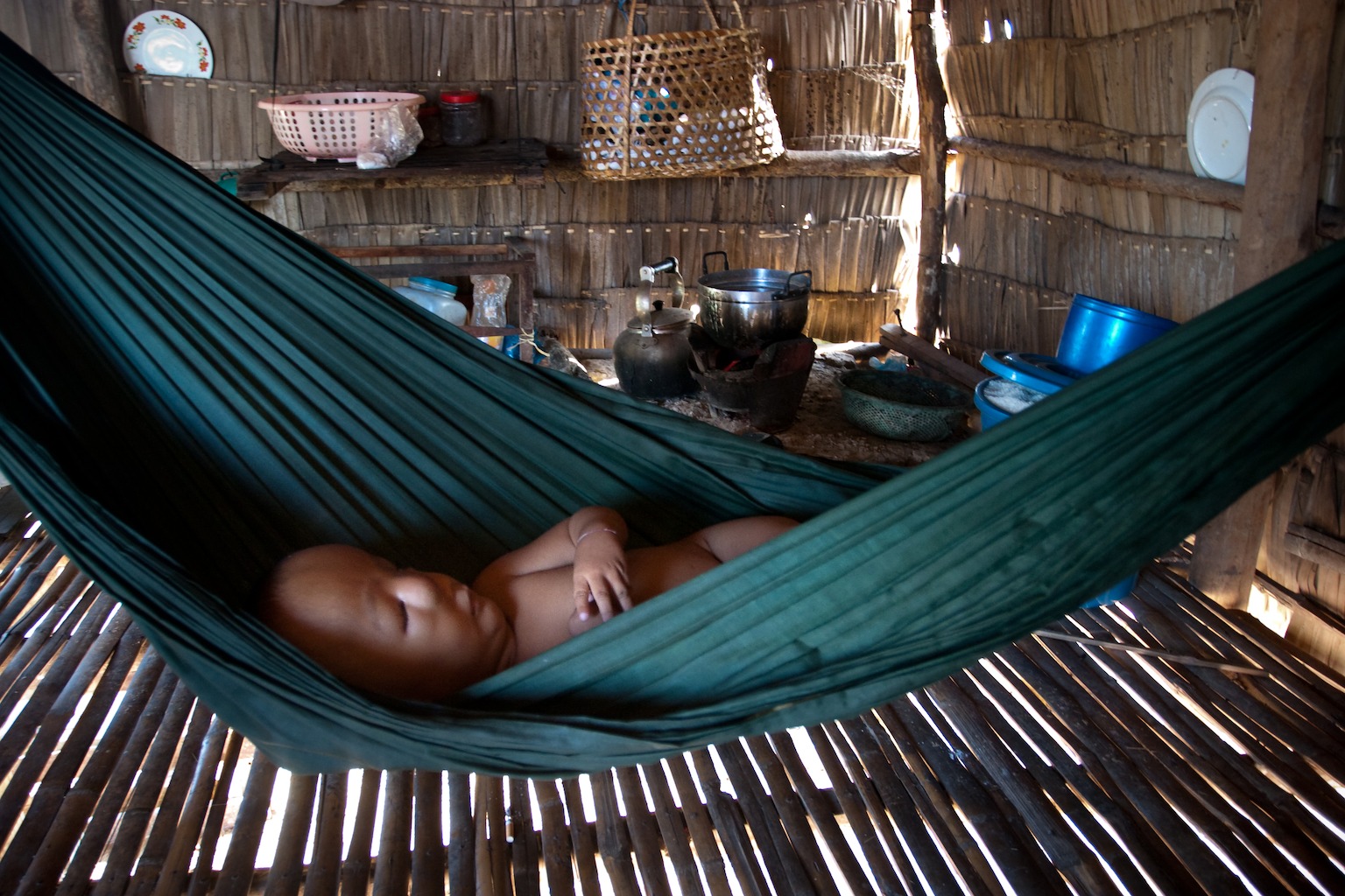Phirum, 5, Third generation Agent Orange victim, naps in a hammock at home in Beng Melea Province, Seim Reap Cambodia. Most of his days are spent with his mother pan handling at the Angkor Wat Temples. Phirum Ung was born in south eastern Cambodia, where thousands of acres were sprayed with a chemical herbicide dioxin coded {quote}Agent Orange{quote}.
