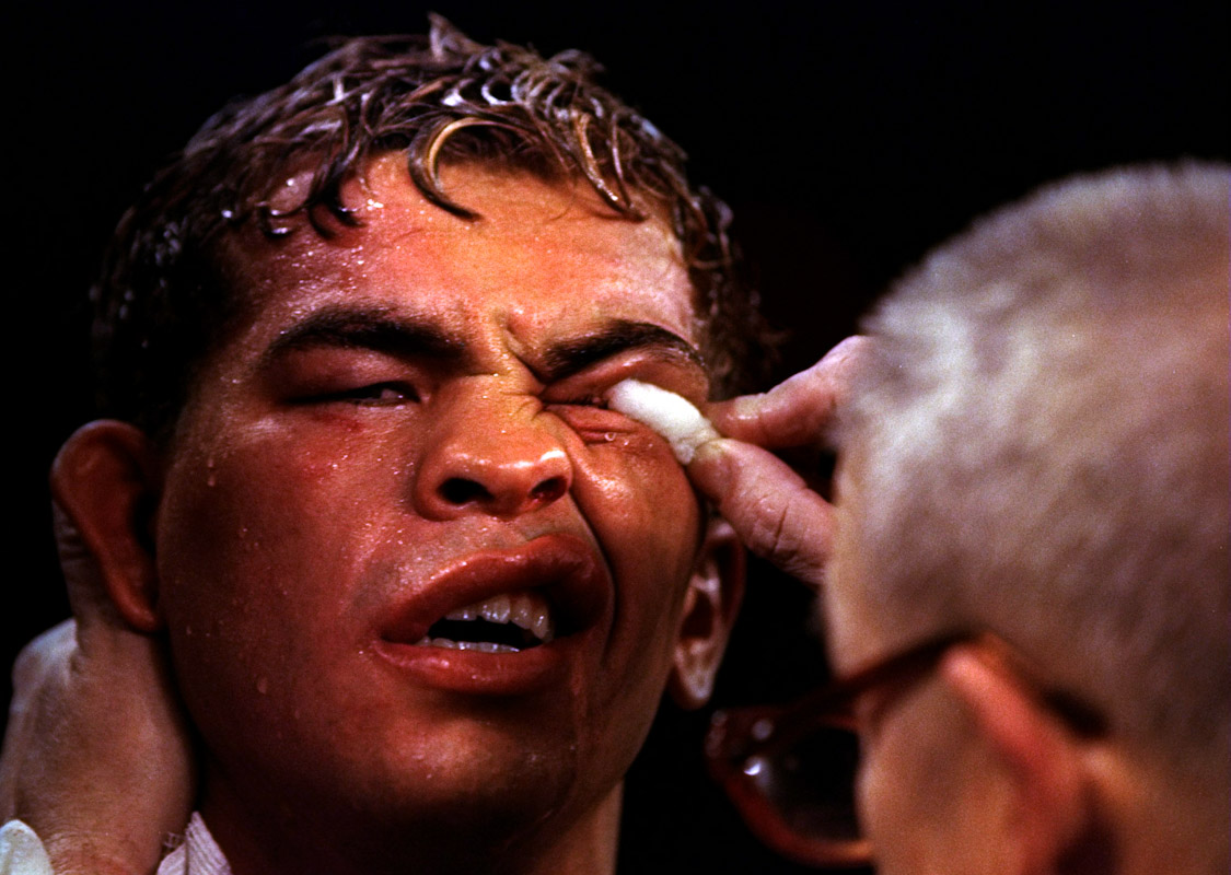 Trainers work on Arturo Gatti left eye as he sits in his corner during the fight against  Ivan Robinson on December 12, 1998 at the Taj Mahal in Atlantic City, New Jersey. Robinson won by a decision in the tenth round