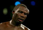 Hasim Rahman shows a bulge on his forehead due to a broken blood vessel after a headbutt by Evander Holyfield during the heavyweight title fight at the Boardwalk Hall in Atlantic City, New Jersey on June 1, 2002. The fight was stopped after the 8th round in Holyfield's favor.  
