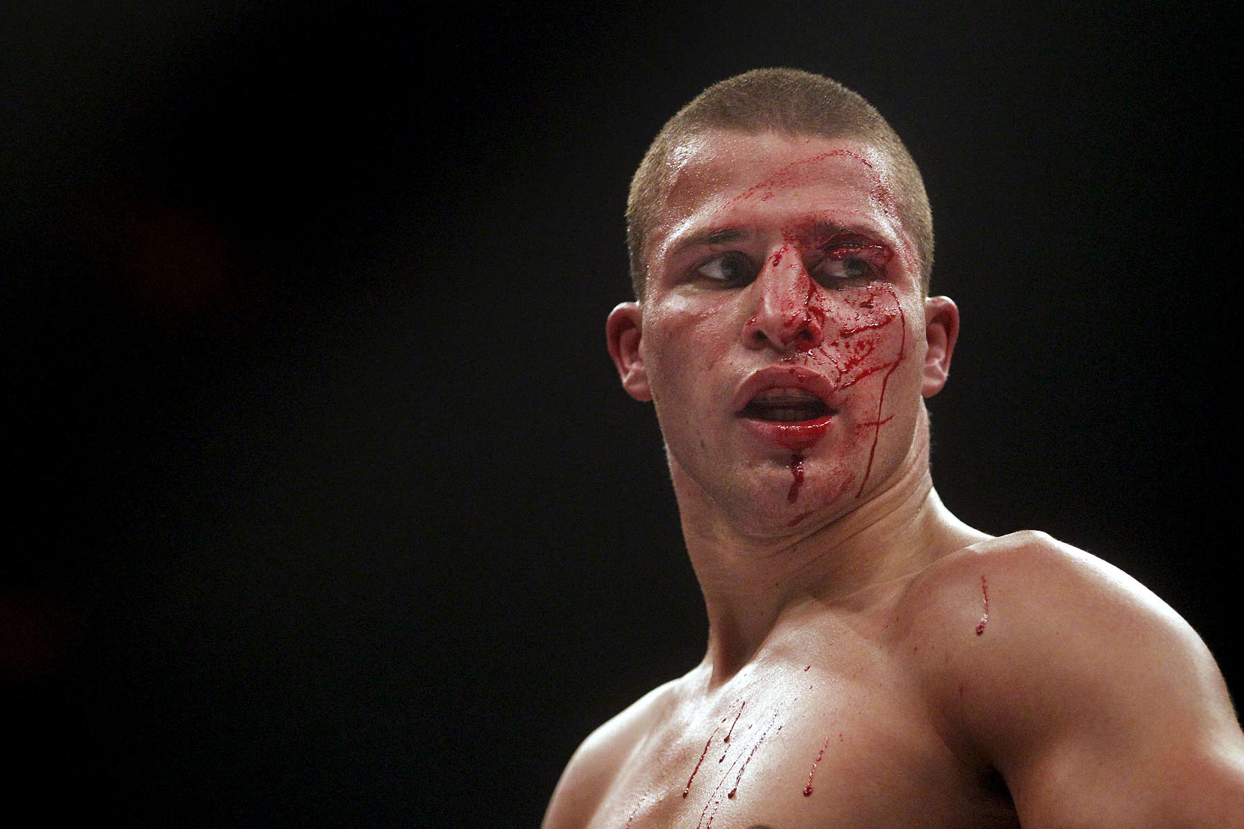 Max Baumert looks off in the distance while bleeding during his match against Josh Jauncey during Friday's SuperFight presented by Glory Sports International at the Hampton Coliseum. The fight was called due to Baumert's injury. 
