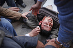 An anti-government demonstrator injured during a clash with President Mubarak's supporters on Tahrir Square on Wednesday February 2 2011