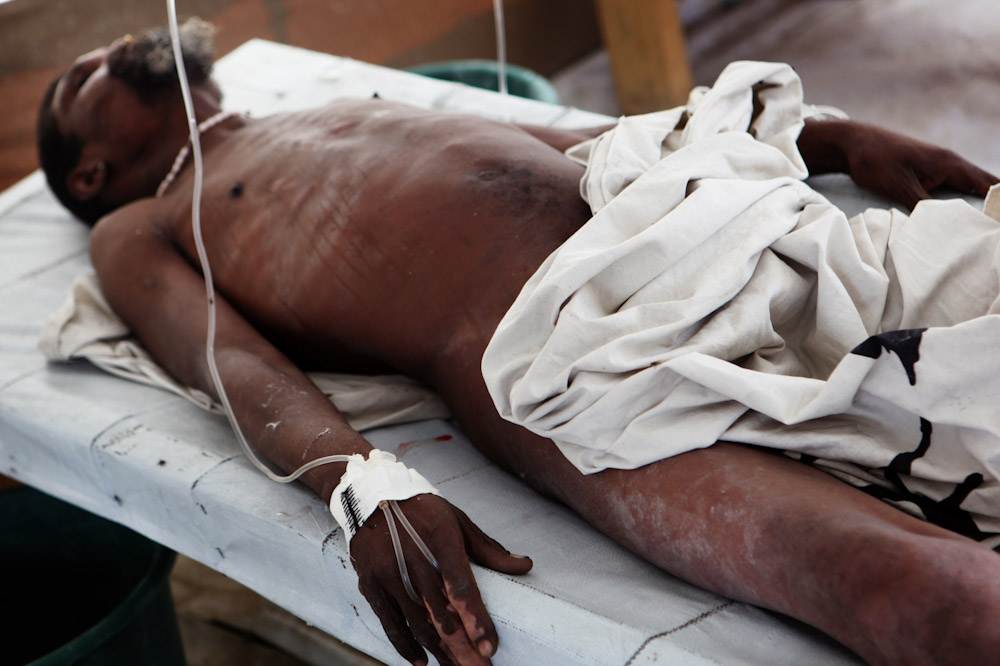 MSF Cholera Clinic