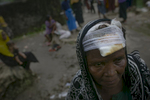 A woman who says that Myanmar military hit her head with a machete is seen in an informal settlement 