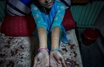 {quote}Samira{quote} shows her self-harm marks in Tangail brothel. She was married at 12 and trafficked to a brothel two weeks later.‘I ran away from my husband after seven days. He was only about 15 or 16, but he raped me so violently that one morning, when I knew he was asleep, I slipped out of the house as quietly as I could, and ran. I left my shoes behind because I didn’t want to wake anyone up. I was so scared about what would happen to me if I was caught. I ran back to my house, but I was too frightened to go inside because I was covered in blood and bruises. My mum died when I was 11, so my brother and sister had arranged the marriage because they couldn’t afford to look after me any more, and I knew leaving my husband would make them angry. So I asked a rickshaw driver to take me across {town} to my friend’s house – but he told me I should be ashamed of myself, and dropped me off at the brothel instead.I didn’t understand where I was. I just saw all of these women wearing weird make up and strange clothes. But I didn’t have anywhere else to go, so I stayed. When they told me I needed to sleep with men for money, I figured it didn’t matter. I’d already been raped. I might as well get paid for it.Sometimes I feel like it was my choice to end up here, because I’m the one who ran away. And I’m the one who didn’t leave. But I don’t understand how I could feel so unhappy if it was my decision. The pimps taught me how to have sex so that it wouldn’t be so painful, but my whole body still aches all the time. Even I ask the customers to be gentle with me, it hurts so much that I can’t help crying out. I can’t remember the last time I didn’t cry at night. Mostly, I cry because I miss my mum.’