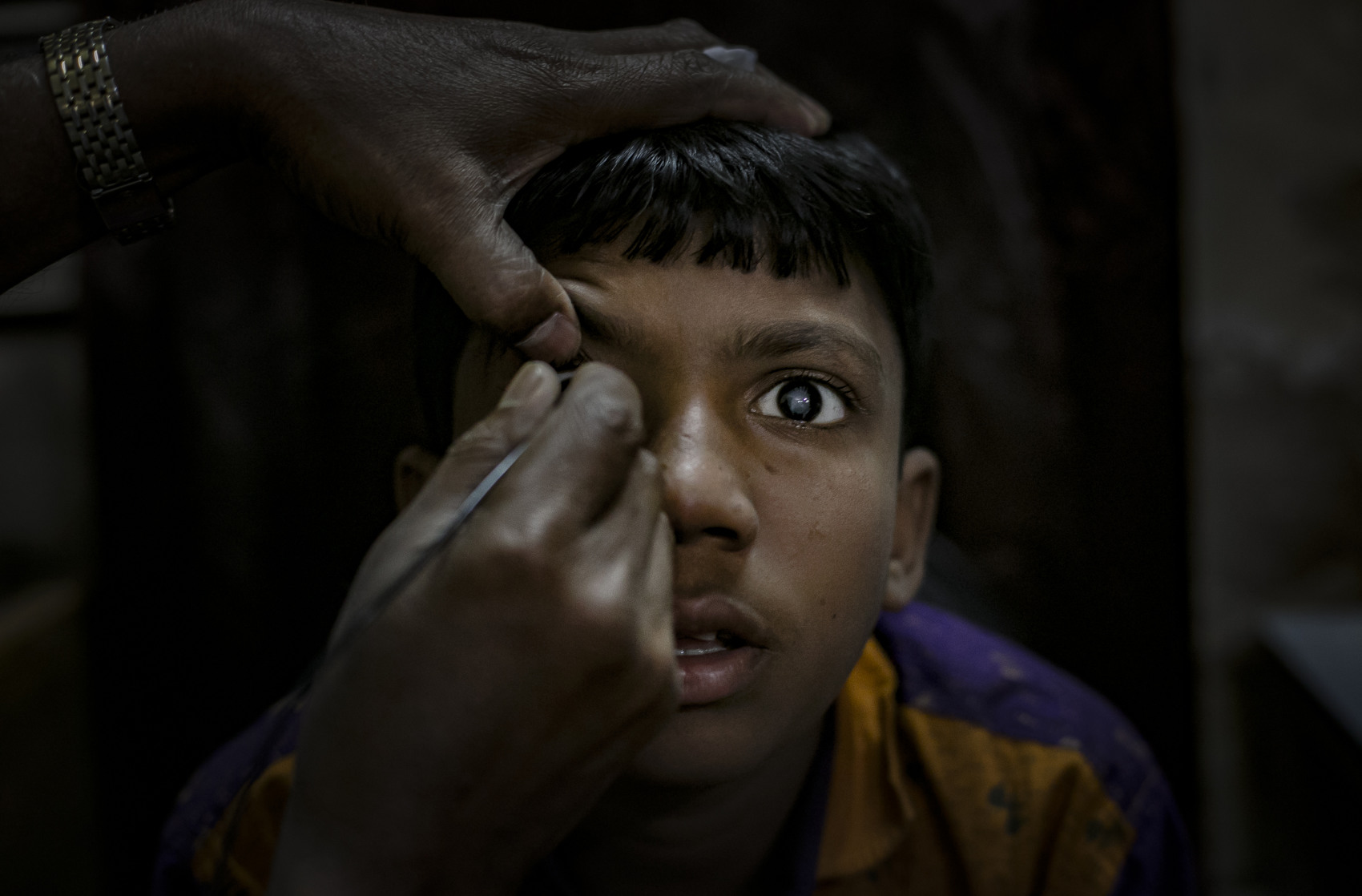 11 year old Rashed is examined before surgery at Khulna hospital March 1, 2017 in Khulna division, Bangladesh. © Sightsavers/Allison Joyce 