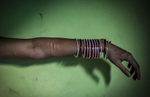A girl shows her self harm scars at a brothel in Bangladesh