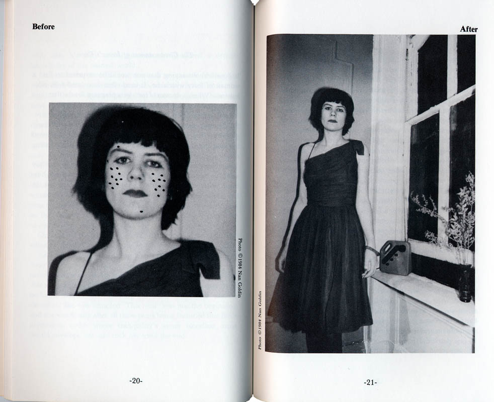 #19-20How to Get Rid of Pimplesby Cookie Muellerphotographs by David Armstrong, Nan Goldin, Peter Hujar1984cover photo by David Armstrong