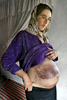HERAT, AFGHANISTAN-OCTOBER 21: Mariam, age 20, 9 months pregnant shows her scars on her belly October 21, 2004 from from self-immolation inflicted 3 months ago when she was devastated by an abusive, violent marriage October 21,2004 in Herat, Afghanistan. She poured household fuel on herself and spent 28 days in the hospital. She now lives with her mother and her husband is moving back in with her and her 2 year old daughter. (photo by Paula Bronstein/Getty Images)