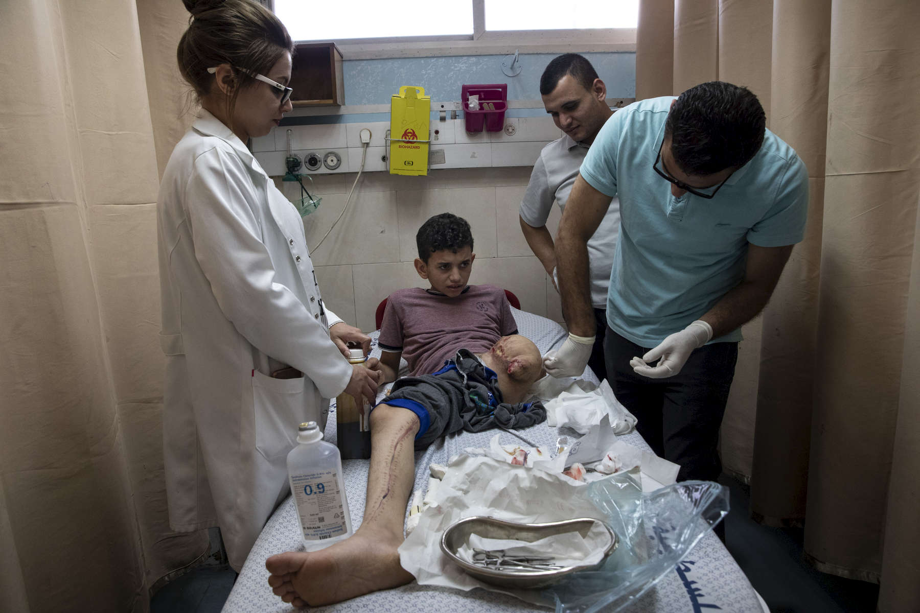 GAZA CITY, GAZA STRIP- MAY 29,2018 Abdullah Al-Anqar, 13, gets medical treatment for his amputated leg at the Al-Shifa hospital on May 29,2018 in Gaza city, Gaza strip. He was shot by twice in his leg at close range with explosive bullets, one in his upper thigh and the other under his knee on May 3rd. He was climbing the Israeli border fence when he was severely injured. The Israel soldiers decided to see his life, dragging him through the border fence, then he was flown to Soroka hospital in Beer Shaba, Israel where he spent 16 days in Intensive care, his leg was amputated there as well. The Israeli military (IDF) started using new weaponry, explosive bullets that shatter bones, tissue, destroying veins and arteries, the aim is to create a handicapped community, especially amongst the young male population. Many of the wounded protesters have to undergo multiple surgeries to try to save their limbs, and in some cases amputation is the only solution. Everyone is well aware that Gaza's two million inhabitants are trapped in a cycle of violence and poverty, created by policies and political decisions on both sides. The problems and complications affecting Gaza today are overwhelming. The world, seemingly accustomed to the suffering of the Gazan people turns a blind eye. (Photo by Paula Bronstein ) 