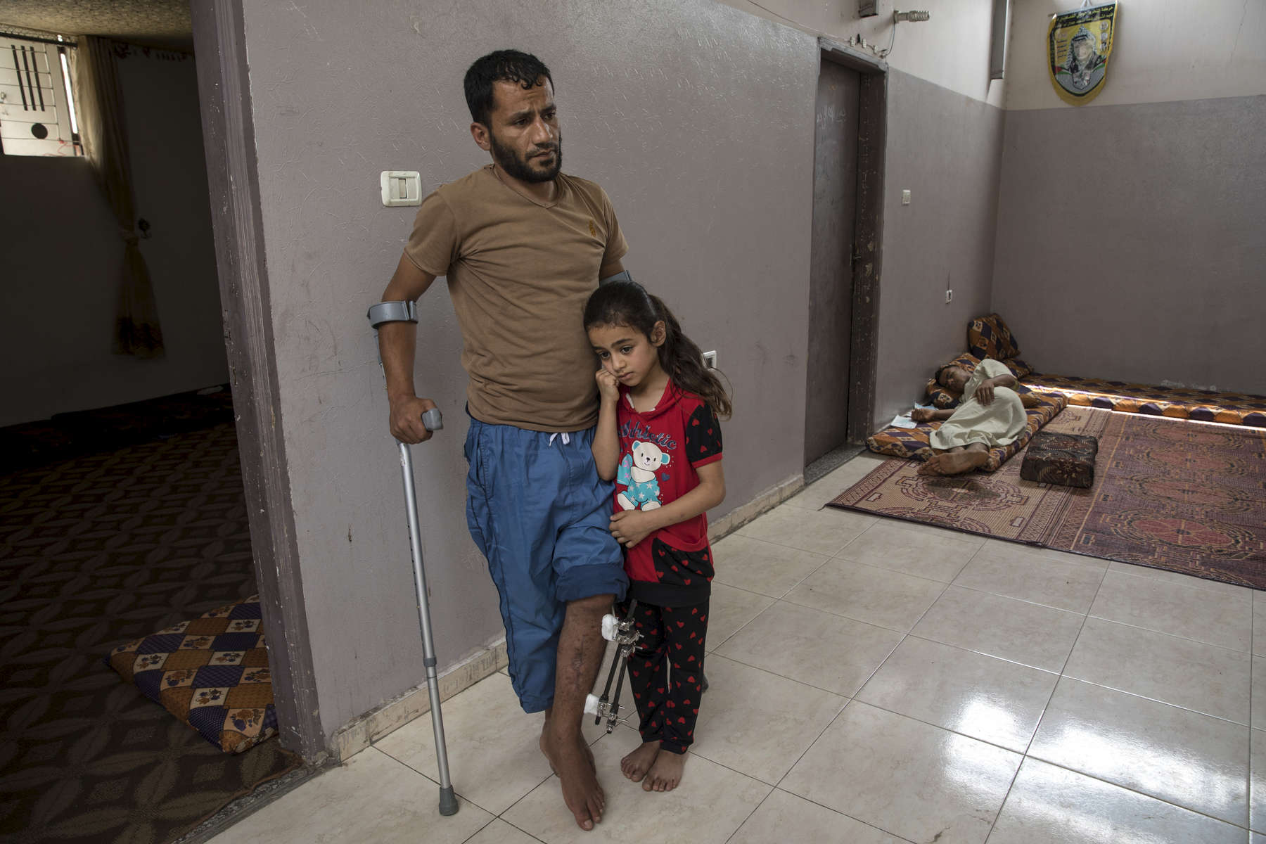 GAZA CITY, GAZA STRIP- MAY 22,2018 : Ahmad Abu Jaser, 31, father of four daughters, hugs his daughter Lyan, age 7, he sustained an injury in his leg along with his brother who was shot twice, in his thigh and back resting on the floor on May 22,2018 in Gaza city, Gaza strip.At least 110 Palestinians were killed during the between March 30-May 15th. According to the International Committee of the Red Cross (ICRC), 13,000 Palestinians were wounded (as of June 19, 2018), the majority severely, with some 1,400 struck by three to five bullets. No Israelis were physically harmed during this time period, Israel's use of deadly force was condemned during the UN general assembly on June 13 th along with other human rights organizations.Everyone is well aware that Gaza's two million inhabitants are trapped in a cycle of violence and poverty, created by policies and political decisions on both sides. The problems and complications affecting Gaza today are overwhelming. The world, seemingly accustomed to the suffering of the Gazan people turns a blind eye. (Photo by Paula Bronstein ) 
