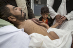KABUL, AFGHANISTAN -MARCH 28, 2016: Khair Mohammed, 35, a paraplegic lays in bed outside his ward as friends and relatives visit him at the emergency hospital as his daughter Madina ,6, looks sadly at her father in Kabul on March 28, 2016. Khair just escaped death after taking 3 bullets to his abdomen and skull. Afghan civilians are at greater risk today than at any time since Taliban rule. According to UN statistics, in the first half of 2016 at least 1,600 people had died, and more than 3,500 people were injured, a 4 per cent increase in overall civilian causalities compared to the same period last year. The upsurge in violence has had devastating consequences for civilians, with suicide bombings and targeted attacks by the Taliban and other insurgents causing 70 percent of all civilian casualties.  
