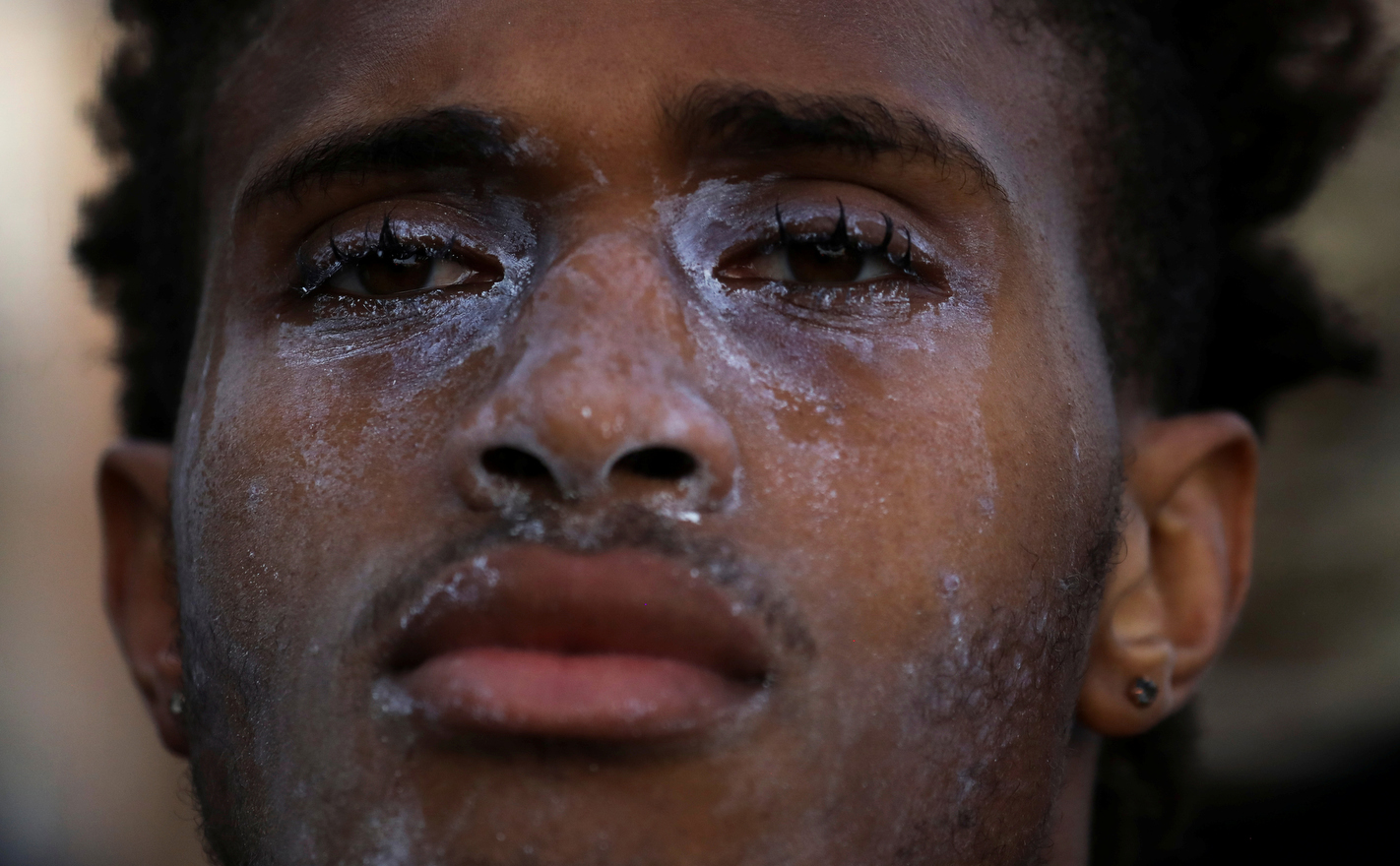 A young man with dried eye wash on his face used to treat tear gas stares at a line of police after a day of protest calling for justice for George Floyd was suddenly broken up by a semi-truck nearly running through a crowd of demonstrators in Minneapolis, Minnesota, U.S. May 31, 2020. Police moved into the agitated crowd and eventually used chemical irritants to disperse them.