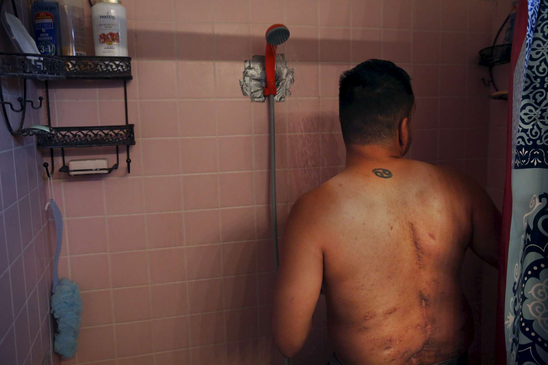 Deep scars from Guillermo's yearslong struggle with Valley Fever can be seen on his back where the disease tried to kill him from inside of his spine as he takes a shower with a temporary, battery powered shower head in his home in Fresno. The poor air quality and increase of dust and air particles has caused an increase in diseases such as Valley Fever. Guillermo purchased the shower head pump to make taking showers with buckets of water easier for him and his mother since their well went dry.